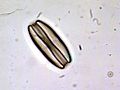 Thumbnail for Amphora (diatom)