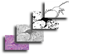 Figure 2. The sequence above shows basic steps in extracting a binary contour pattern from an original colour digital image of a neuron. Binarizing neuron image.png