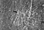 Vignette pour Structure rayonnée