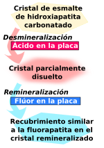 Miniatura para Remineralización de los dientes