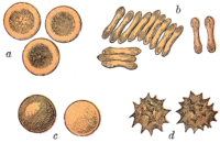 In (d) the RBCs are rendered crenated from a hypertonic solution Gray453.png