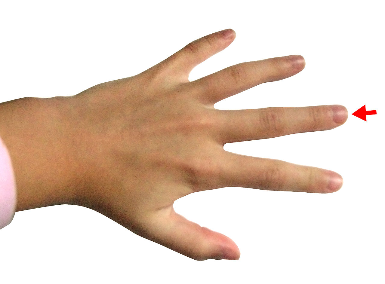 File:Middle finger BNC.jpg - Wikimedia Commons