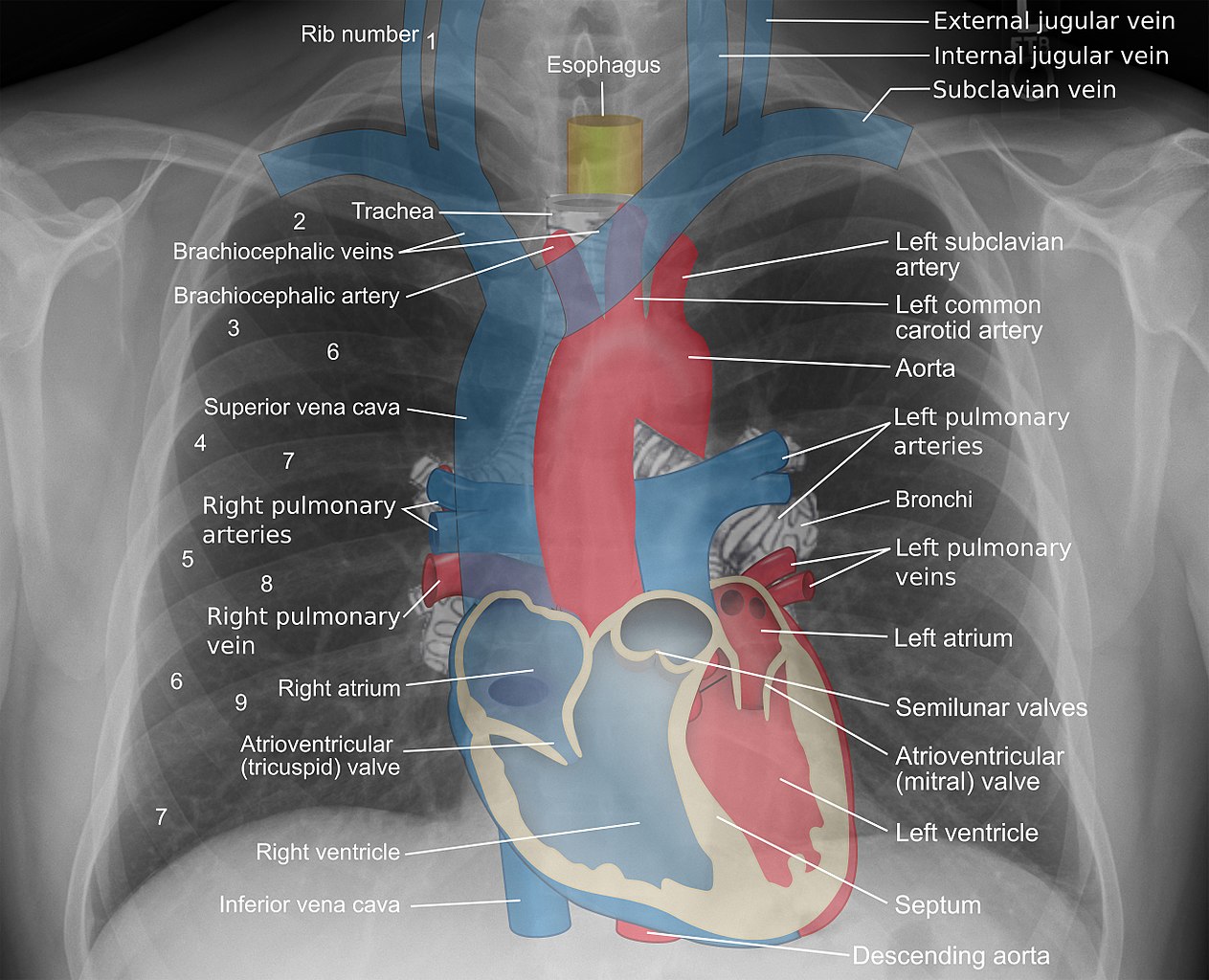 File:Mediastinal structures on chest X-ray, annotated.jpg ...