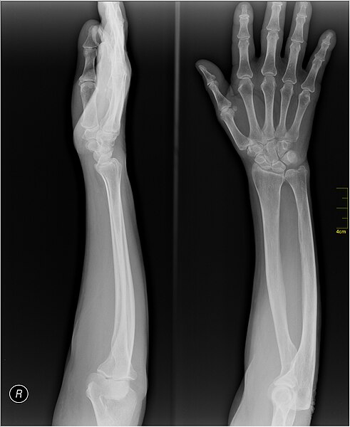 File:Medical X-Ray imaging VMR07 nevit.jpg