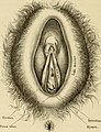 Pathologische Anatomie der weiblichen Unfruchtbarkeit (Sterilität); deren Mechanik und Behandlung (1878) (14577823720).jpg