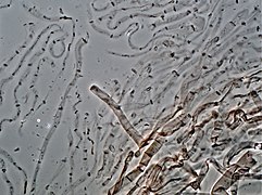 Grzyby Skórka: Budowa makroskopowa, Budowa mikroskopowa, Galeria obrazów mikroskopowych skórki grzybów