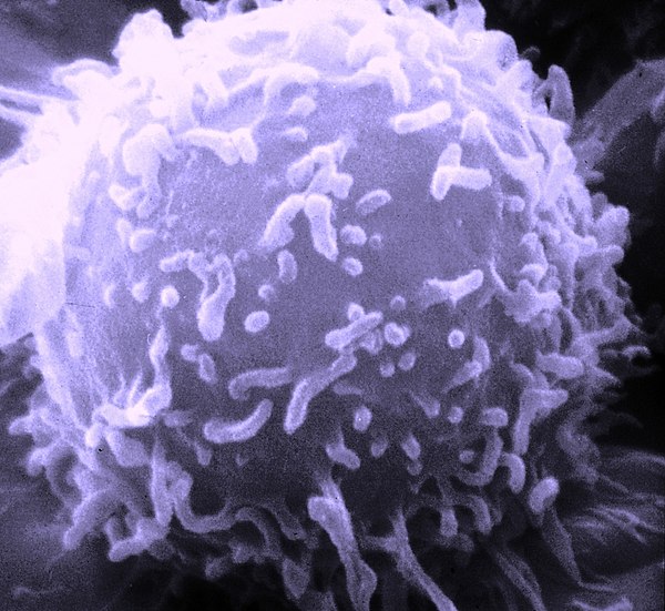 A scanning electron microscope image of a single human lymphocyte