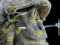 Anatomisches Präparat mit freigelegtem Nervus hypoglossus