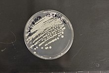 Streptomyces albireticuli NRRL B-1670 9.jpg