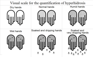 Hyperhidrosis condition characterized by abnormally increased sweating