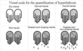 Focal hyperhidrosis Medical condition