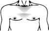 15 - Circumaréolaire-pecto-sterno-infraclaviculaire.png