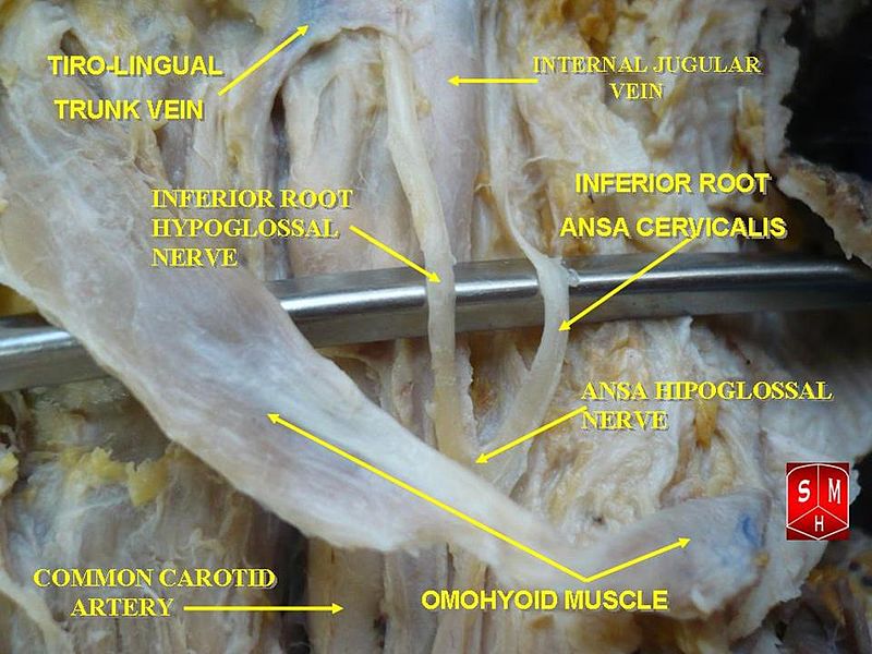 File:Ansa cervicalis.jpg