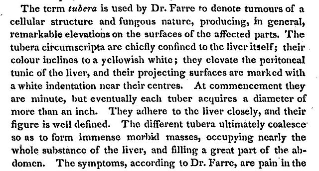 An 1814 American medical text showing British English spellings that were still in use ("tumours", "colour", "centres", etc.)