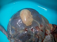 Fetus papyraceus.JPG