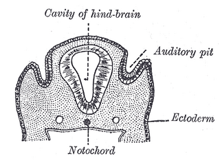 <span class="mw-page-title-main">Otic pit</span>