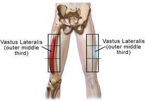 Injection Sites Intramuscular Thigh Adult.png