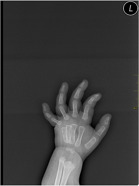 File:Medical X-Ray imaging WJB07 nevit.jpg