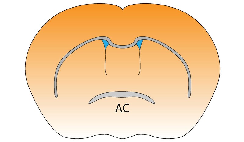 File:Mouse Anterior Commissure.pdf