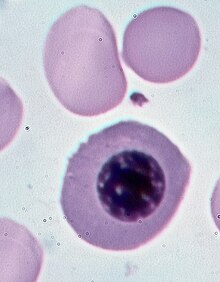 Normocyte, Giemsa stain Normocyte.jpg