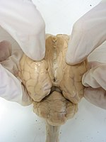 これはヒツジの脳。左右の大脳半球の間の溝（大脳縦裂）を開き、下にある脳梁を露出させている。