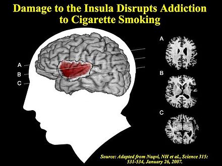 Individuals who sustained damage to the insula were able to more easily abstain from smoking.[174]