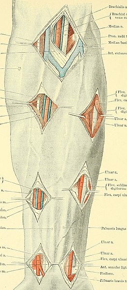 File:Text-book of operative surgery (1911) (14577060068).jpg