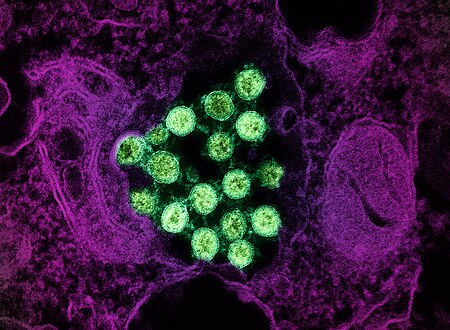 Transmission electron micrograph of SARS-CoV-2 virus particles (omicron)colorized green