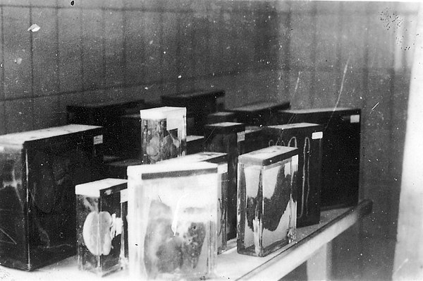 Buchenwald 16 April 1945. Collection of prisoners' internal organs. Photo taken by Jules Rouard, military volunteer incorporated to the 1st American A