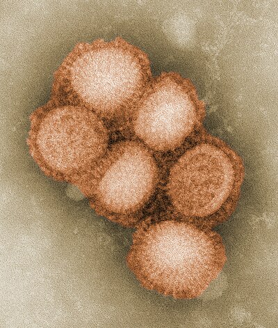 Swine influenza