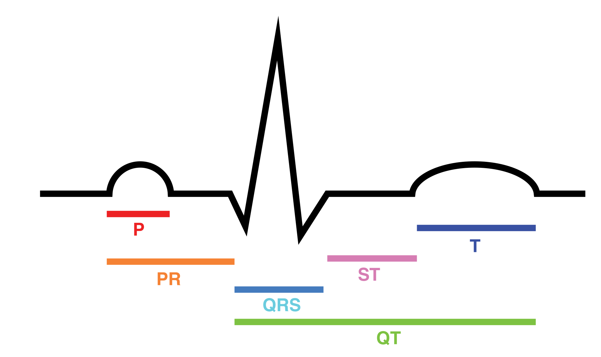 ECG