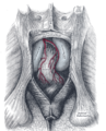 Постериорен поглед на правото црево и анусот, претходно отстранет е скротумот.