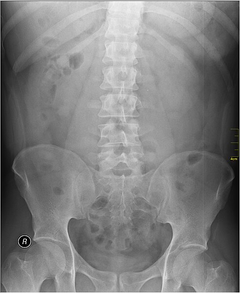 File:Medical X-Ray imaging TVX07 nevit.jpg