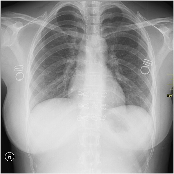 File:Medical X-Ray imaging WQC07 nevit.jpg