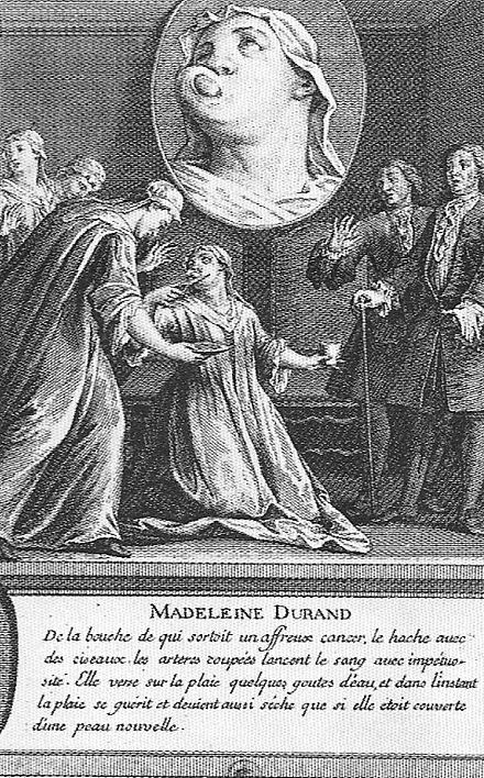 Engraving of a Jansenist cancer cure, c.1730. Miracle janseniste.jpg