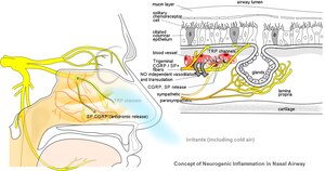 Rhinitis