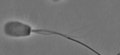 File:Self-Sustained-Oscillatory-Sliding-Movement-of-Doublet-Microtubules-and-Flagellar-Bend-Formation-pone.0148880.s002.ogv