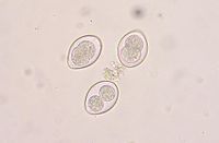 Coccidia.JPG