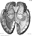 Gehirnabbildung Auszug aus Reil 1812, Band XI, Tafel XIII