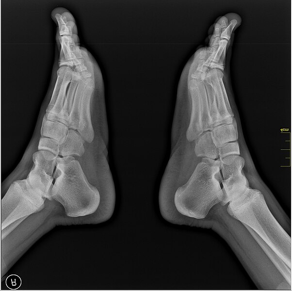 File:Medical X-Ray imaging TRW07 nevit.jpg