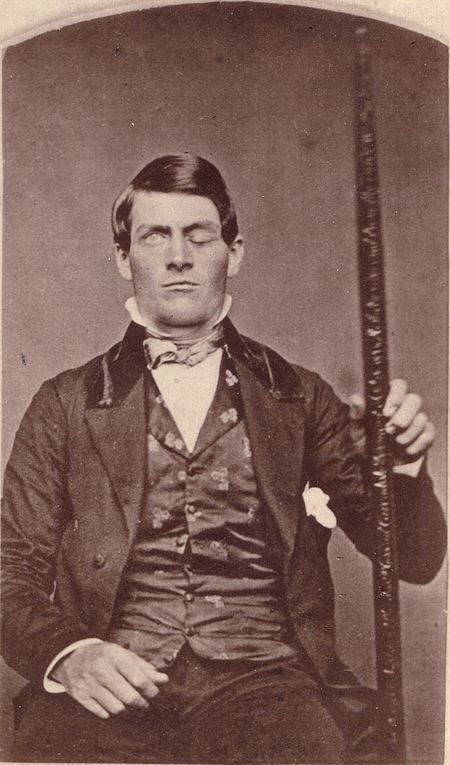 ไฟล์:Phineas Gage GageMillerPhoto2010-02-17 Unretouched Color Cropped.jpg