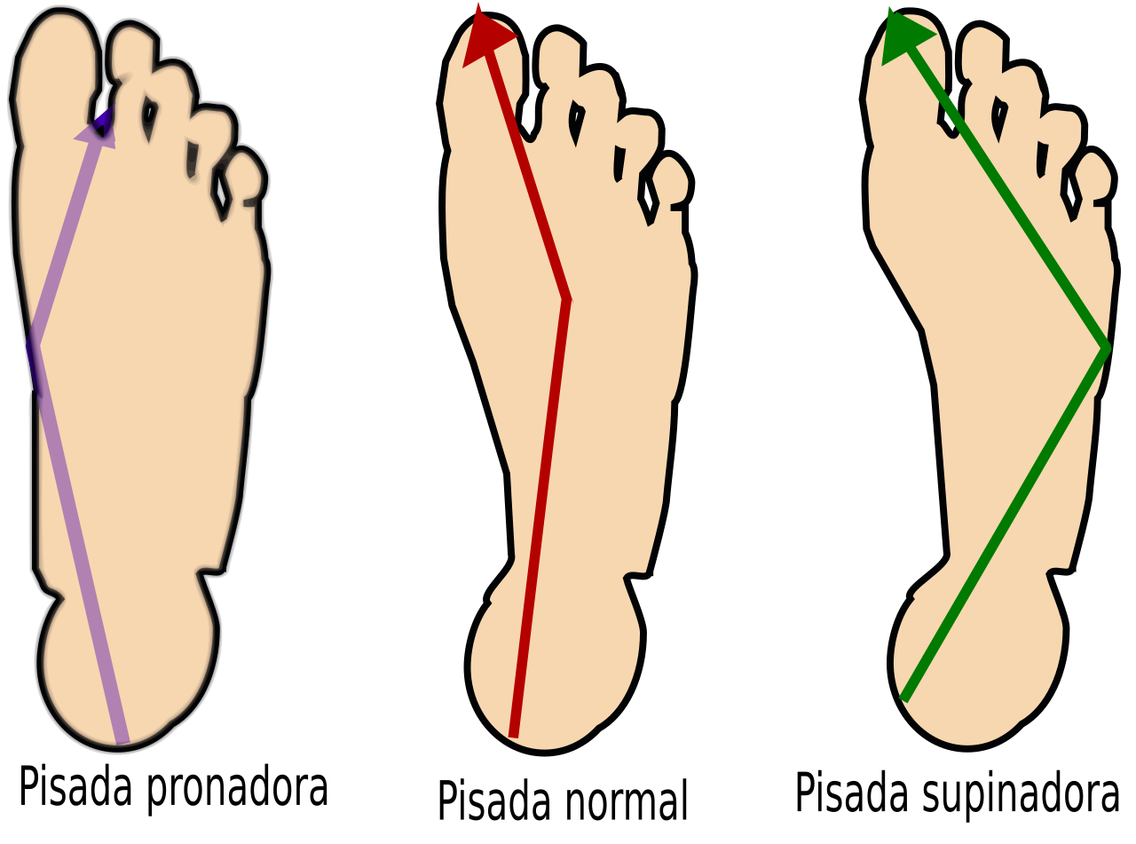 Pronation of the foot - Wikipedia