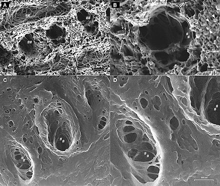 Comparison of SEM (top) and SHIM (bottom) images of mouse enamel. SHIM images have a superior depth of field, showing internal structure in enamel tunnels, which appear as black spots in SEM images. SEM vs HIM imaging of mouse enamel.jpg