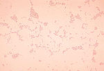 Thumbnail for Actinobacillus