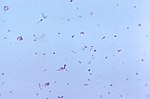 Thumbnail for Clostridium tertium