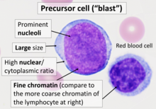 Cytology of a precursor (blast) cell, with features often seen even after partial differentiation into any of the more specific cell types. Wright's stain. Cytology of precursor (blast) cell.png
