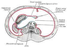 Horizontální řez břišní dutinou v úrovni foramen omentale