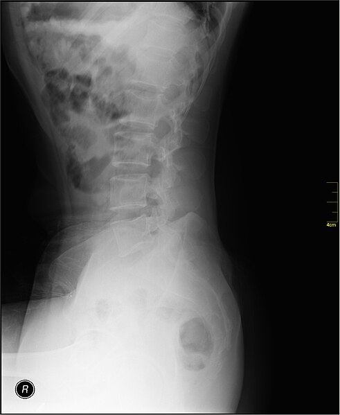 File:Medical X-Ray imaging AFX02 nevit.jpg