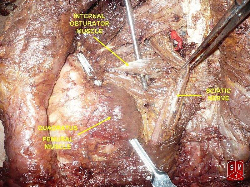 File:Obturator internus muscle.jpg