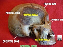 Occipital bone